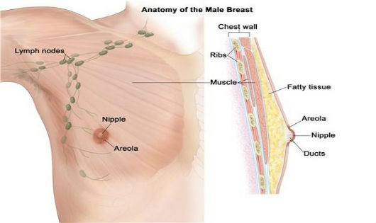 Ảnh 3 của Ung thư vú ở nam giới